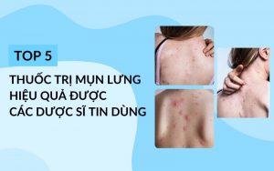 thuốc trị mụn lưng