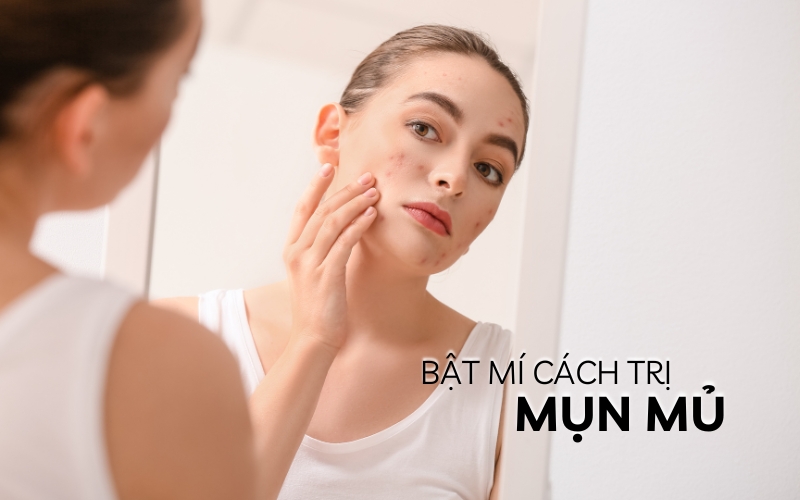 cách trị mụn mủ