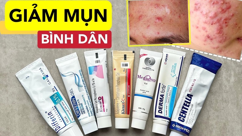dùng thuốc trị mụn