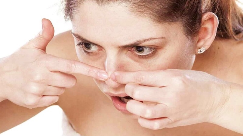 khi nào nên nặn mụn